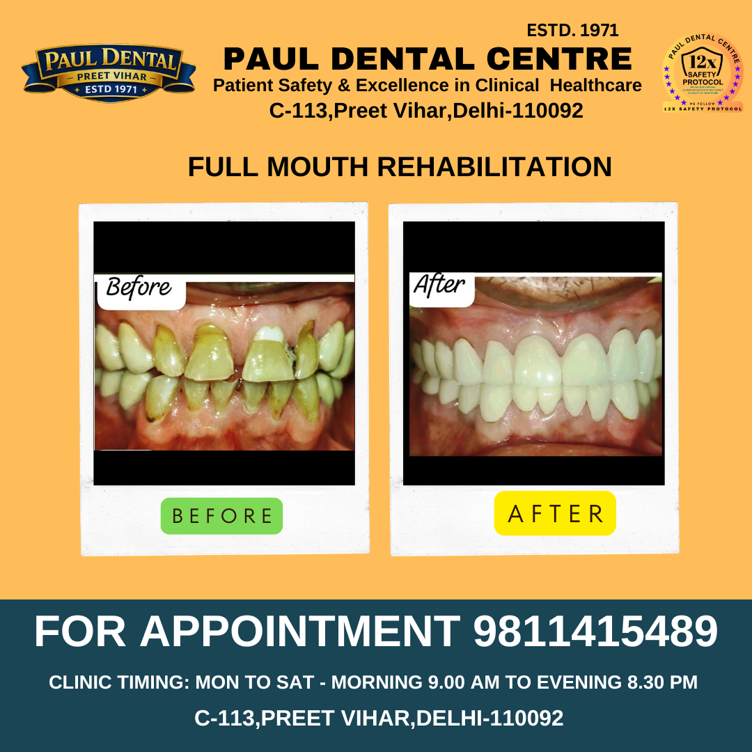 Case 31 – Paul Dental Center